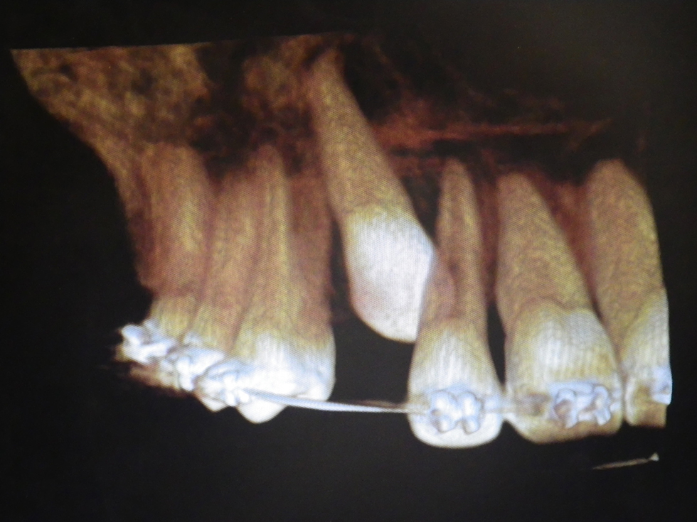 Michael-Riordan-Orthodontics-3d-xray-3